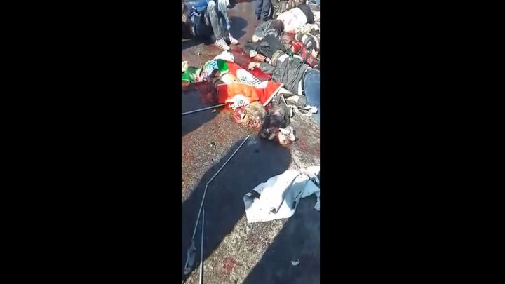 Новые шокирующие кадры с самого кровавого теракта в истории Турции Новые шокирующие кадры с самого кровавого теракта в истории Турции