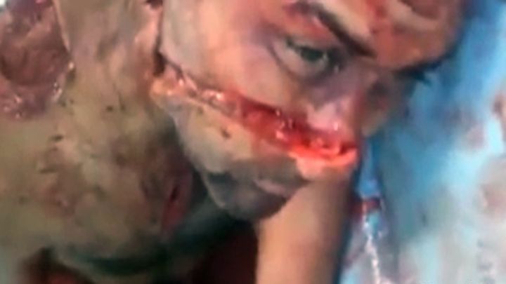 Последствия нападения ягуара Последствия нападения ягуара