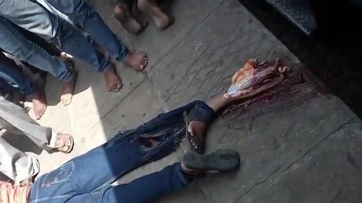Поездом ампутировало ногу Поездом ампутировало ногу