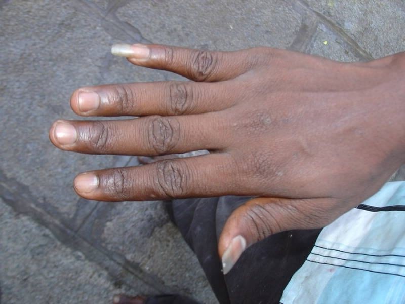 Long fingernails