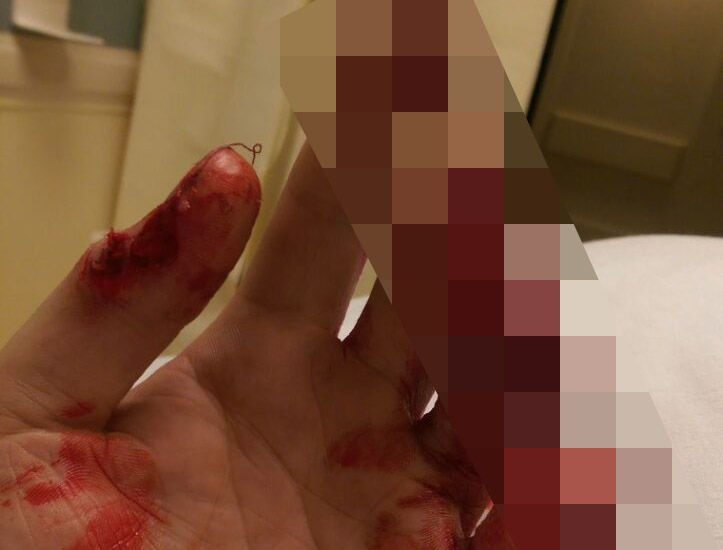 Рабочий отсек себе три пальца на руке Рабочий отсек себе три пальца на руке