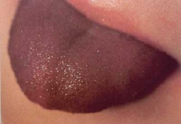 color de tu lengua