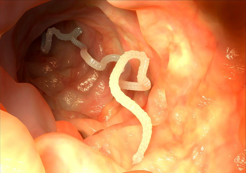 5. Ленточные черви в кишечнике существо, тело