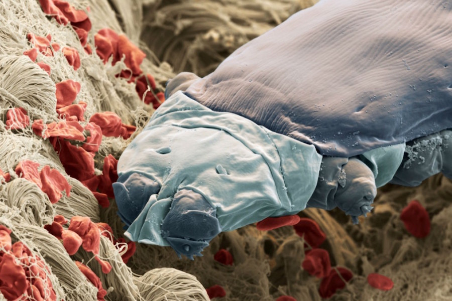 17. У большинства людей в ресницах живут микроскопические клещи демодекс, у которых есть когти и рот. интересное, удивительные факты, факты