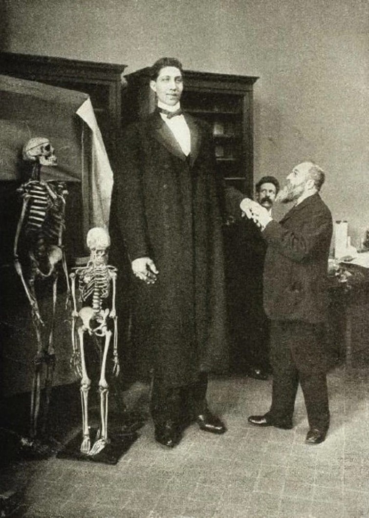 Федор Махнов, его рост был 285 сантиметров при весе около 182 кг, 1900-е. внимание, история, фото