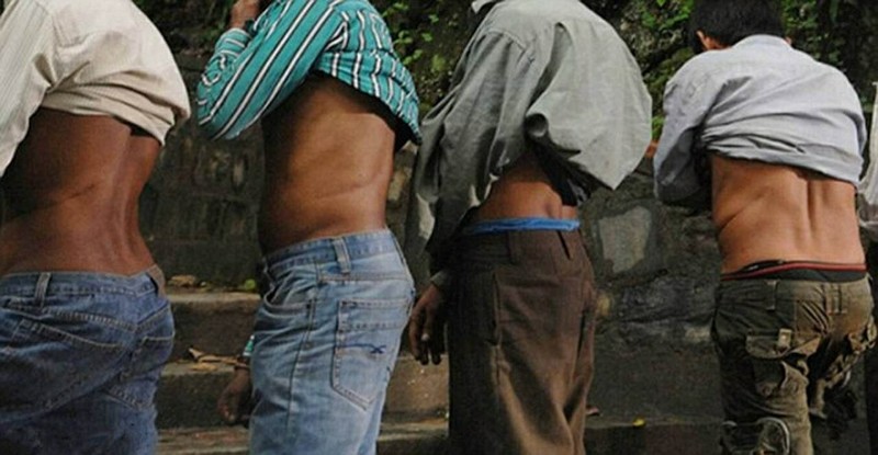 Мужчины деревни Хоксе в Непале демонстрируют шрамы от операции после удалении почек. деревня Хоксе, почка на органы, факты