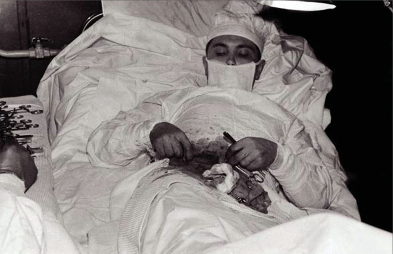 Доктор Леонид Розогов сам себе проводит операцию по удалению аппендицита. Где-то в Антарктиде, 1961 год. знаменитости, история, редкие кадры, фото