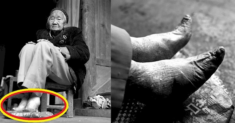 Последние китаянки с "лотосовыми ножками" бинтование, женщина, китай, обычай, стопа