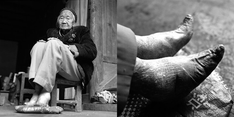 Последние китаянки с "лотосовыми ножками" бинтование, женщина, китай, обычай, стопа