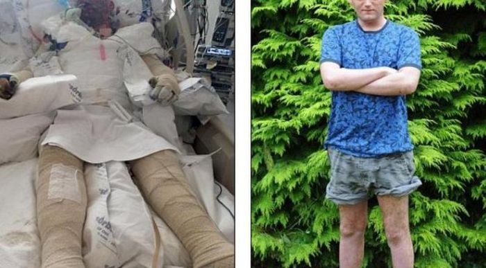 Жуткая аллергия на лекарственный препарат Жуткая аллергия на лекарственный препарат