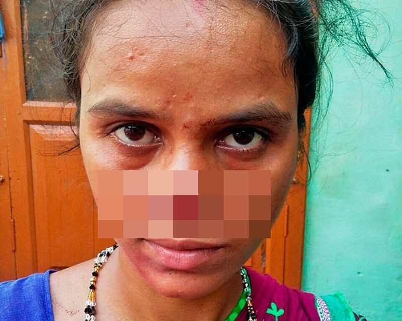 Обидевшись из-за приданного, индиец отрезал жене нос и сбежал с ним Индиец, нос, приданное