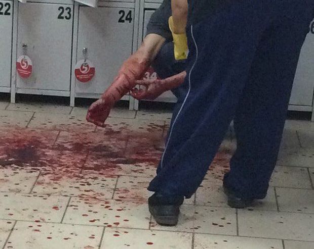 В Нижнекамске магазинный вор вскрыл себе вены В Нижнекамске магазинный вор вскрыл себе вены