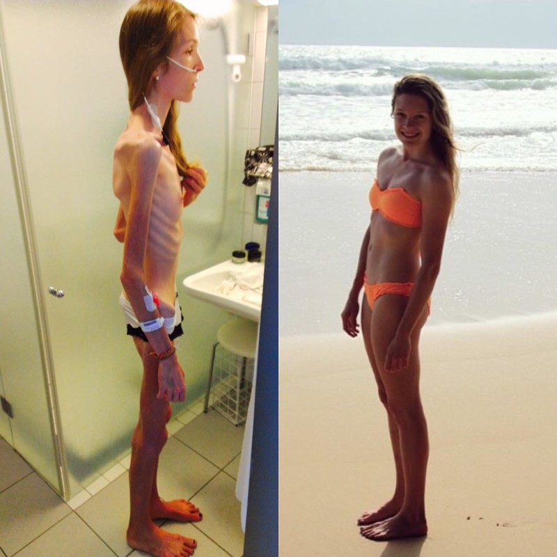 The girl shows, on what was similar when weighed 31 kilograms, and the body, a figure, leanness warns the others
