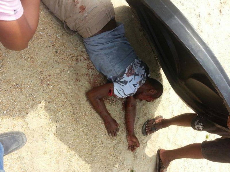 В Малайзии мужчину порубили мачете, но он остался жив В Малайзии мужчину порубили мачете, но он остался жив
