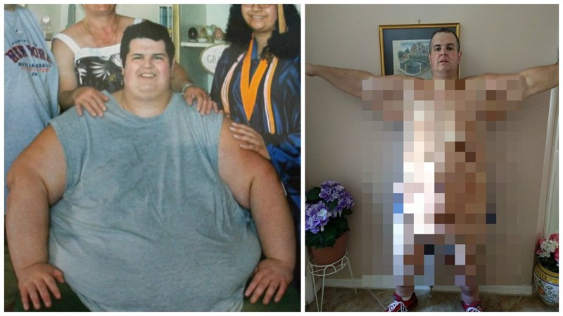 Мужчина весом более 320 кг сумел похудеть. Но повисла огромная проблема! видео, до и после, ожирение, похудение