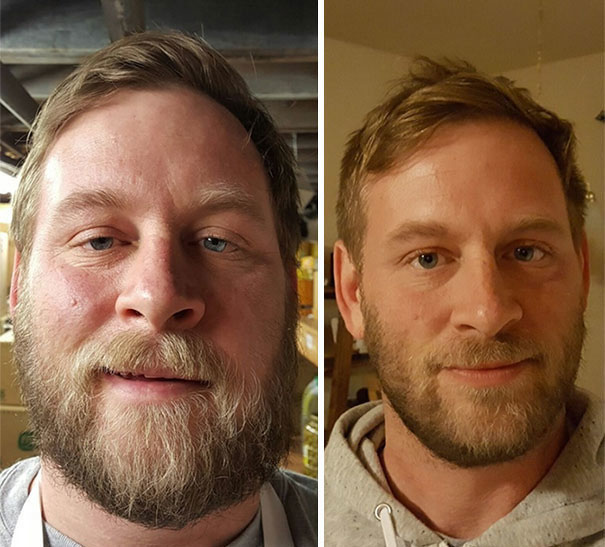 Через 7 месяцев трезвости алкоголь, до и после, здоровье, трезвость, фото