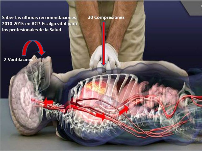 reanimacion-cardiopulmonar.jpg