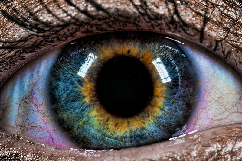 Центральная гетерохромия  гетерохромия, глаза, мутация, цвет
