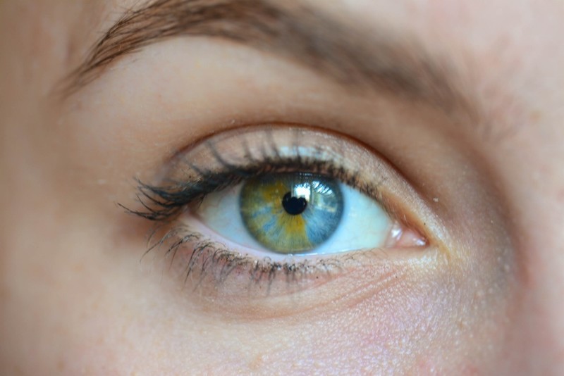 Частичная гетерохромия  гетерохромия, глаза, мутация, цвет