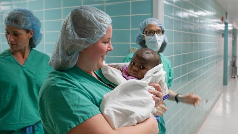 Этой малышке, родившейся с 4 ногами, сделали рискованную операцию по удалению двух из них дети, операция