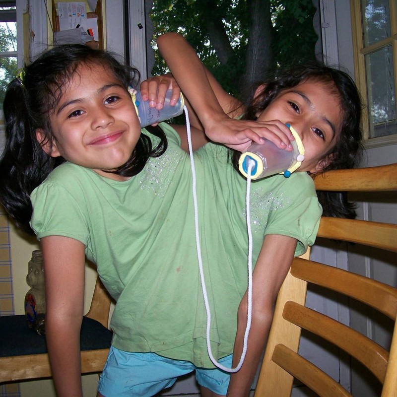 Лупита и Кармен: Невероятная жизнь девочек-сиамских близнецов близнецы, дети, история