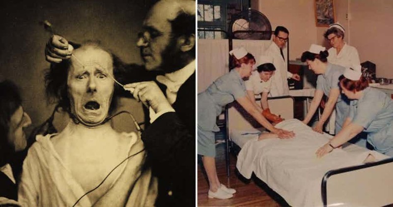 15 жутких вещей, которые были позволены врачам прошлого медицина прошлого, медицинские истории