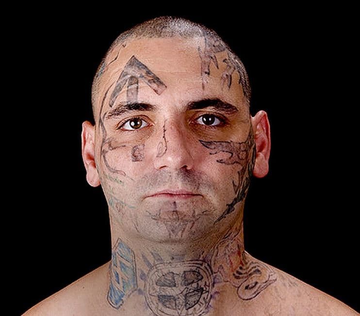 Бывший нацист сделал 25 операций, чтобы избавиться от расистских татуировок любовь спасает, нацист, новая жизнь, перерождение, поучительно, расизм, сведение татуировок, тату