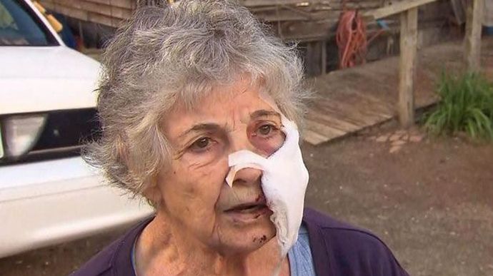 80-летняя женщина пострадала от нападения рыси 80-летняя женщина пострадала от нападения рыси