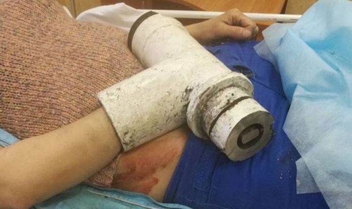 В детском лагере в Петербурге руку женщины затянуло в мясорубку В детском лагере в Петербурге руку женщины затянуло в мясорубку