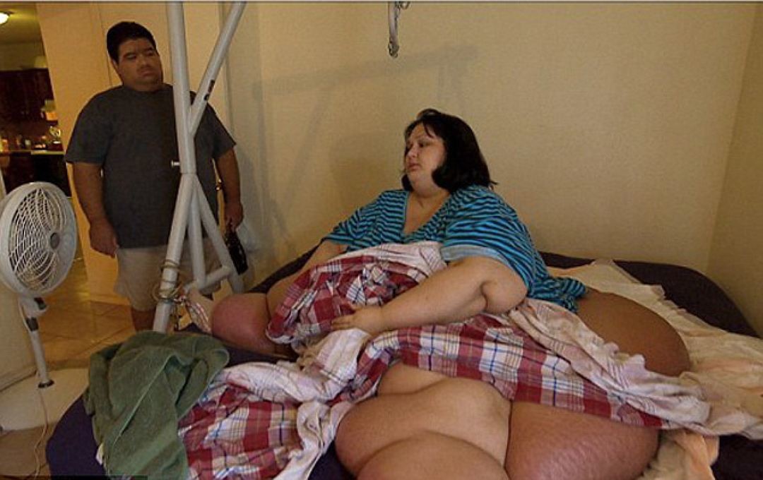Майра Лизбет Росалес и ее муж. Сейчас женщина, весившая когда-то более 500 килограмм, похудела на 400... Любовь, интересное, семья, толстяки
