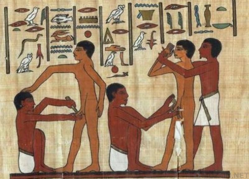 Обрезание древний египет, история, медицина