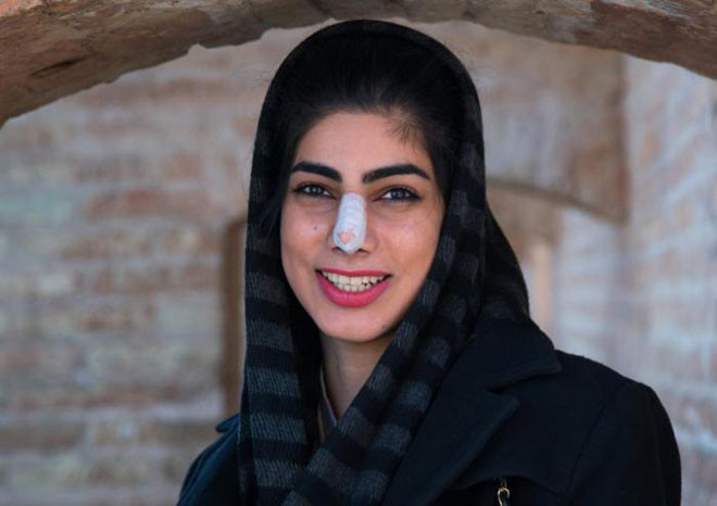 Хирургические повязки на лице, Иран в мире, внешность, женщины, красота, культура, люди, стандарт, шок