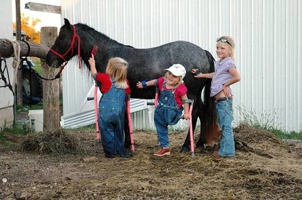 От этих тройняшек отказались родители. вот, что случилось с ними 14 лет спустя От этих тройняшек отказались родители. вот, что случилось с ними 14 лет спустя дети, история, сиамские близнецы