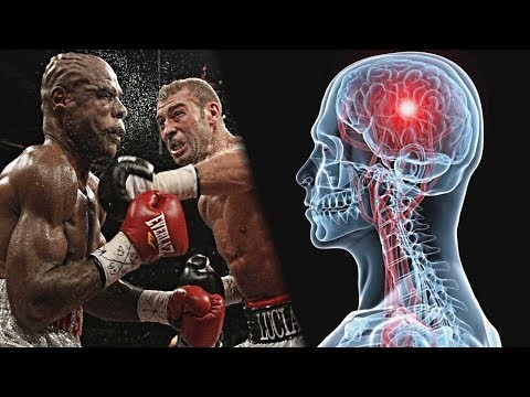 Анатомия нокаута. О чем умалчивают?! Анатомия нокаута. О чем умалчивают?!