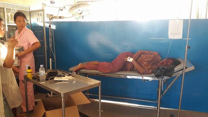 Велосипедистка получила серьёзные травмы лица Велосипедистка получила серьёзные травмы лица