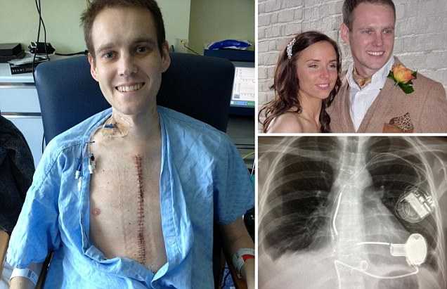 Во время медового месяца британец умер шесть раз