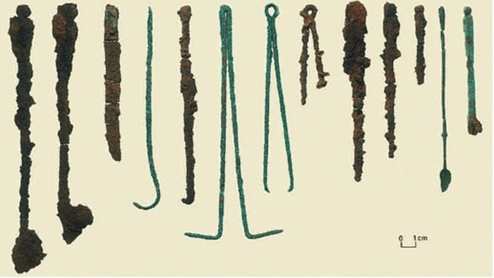 Загадочная древняя хирургия