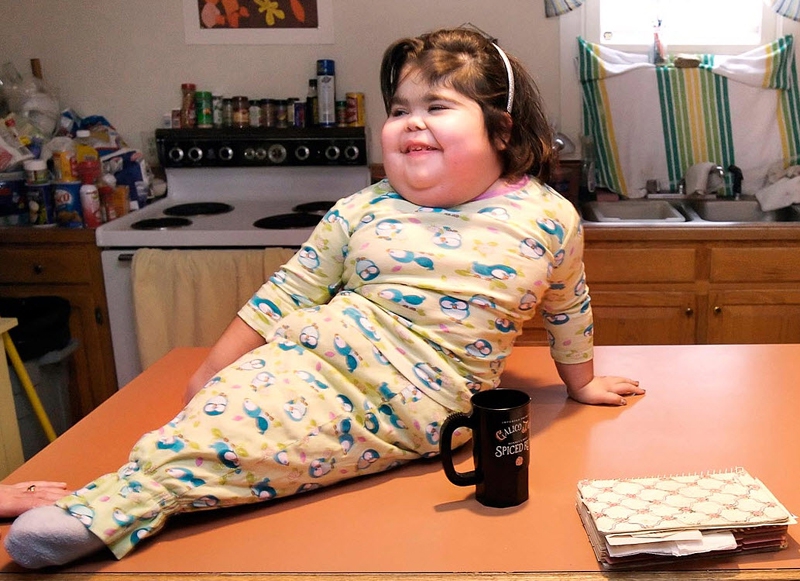 Редкие болезни и отклонения