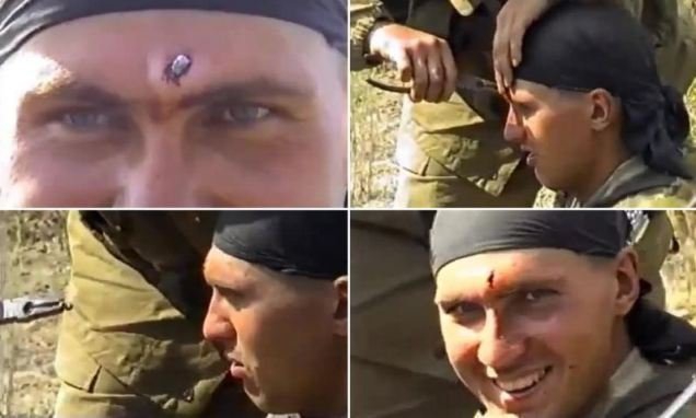 Российский солдат выжил после пули в лоб