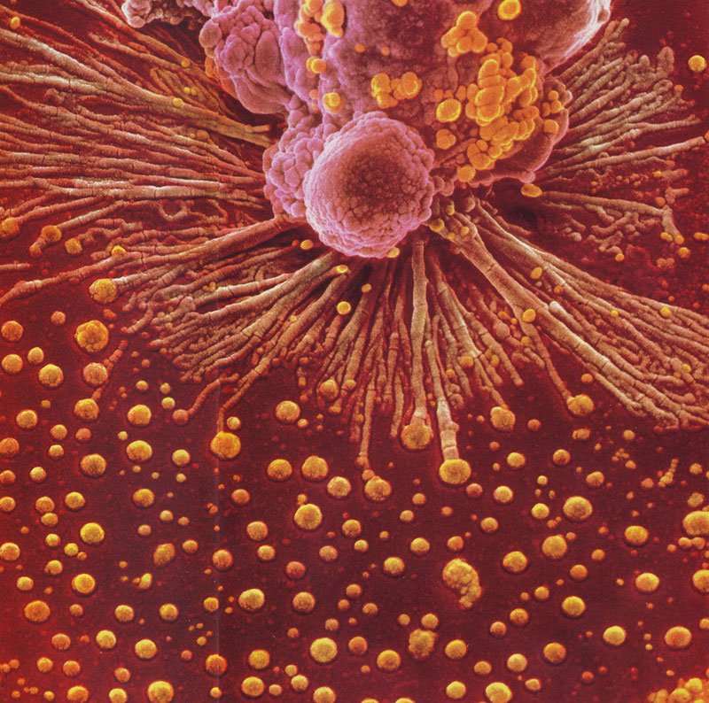 Клетки врожденного иммунитета картинки thumbnail