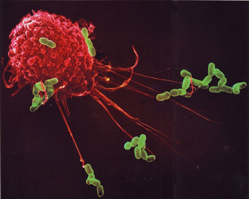 Клетки иммунитета под микроскопом thumbnail