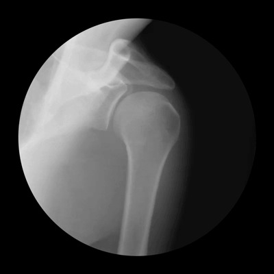 Гифки рентгеновских снимков, демонстрирующие движения костей 