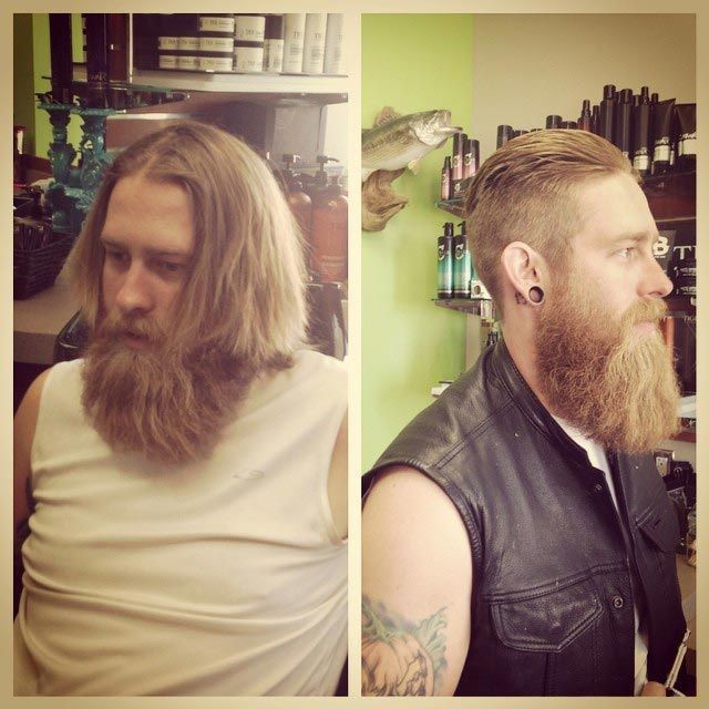 Волосы мужчины до и после thumbnail