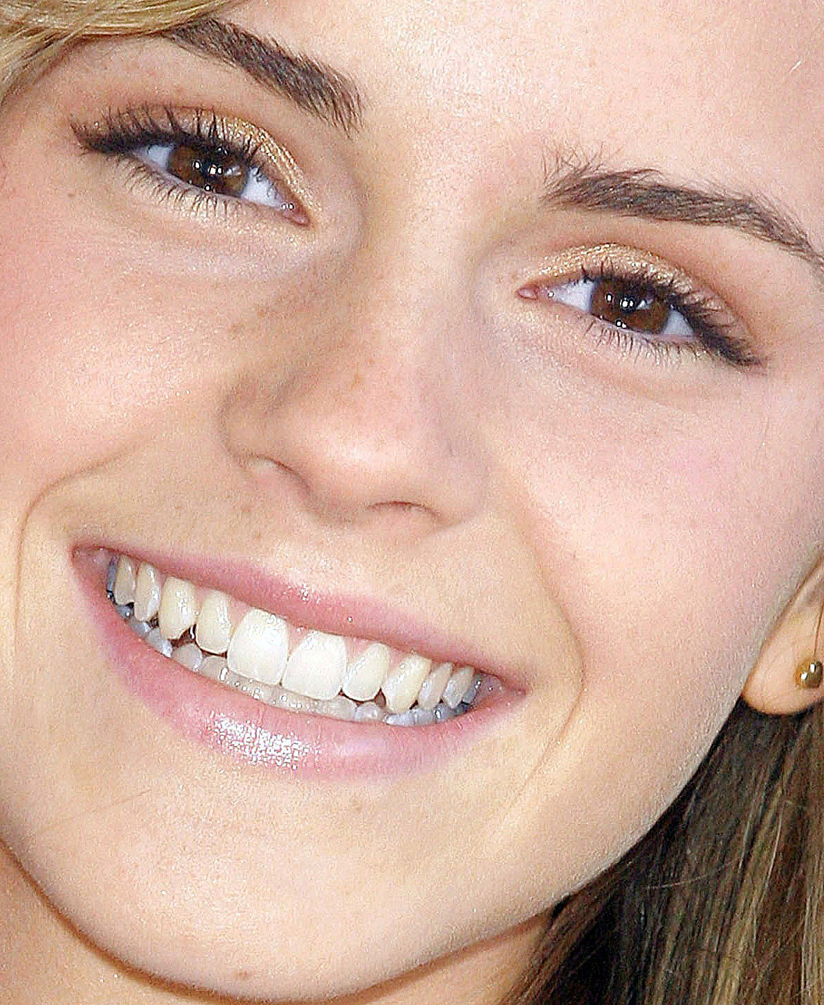 Эмма Уотсон зубы 2005