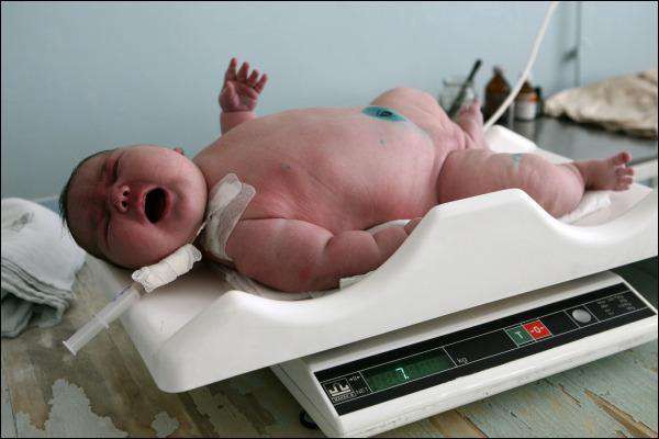 6.	Младенец 7,7 кг, Алтай