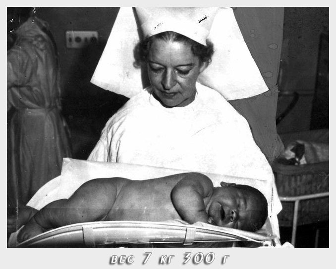 8.	Младенец 7,3 кг. Джон Сочаки, 1963 год