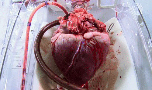 9. Сердце взрослого человека в среднем бьется с частотой от 60 до 100 ударов в минуту. 