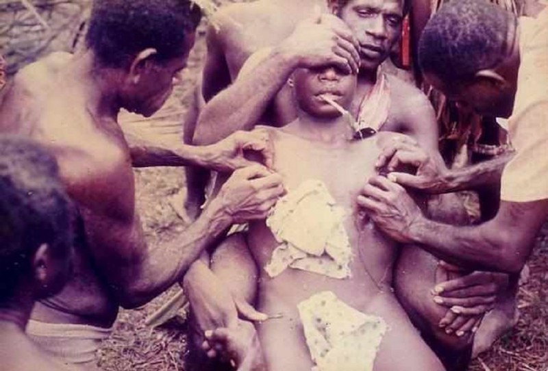 3.  Мардуджара - племя практикующее необычное обрезание и меатотомию 
