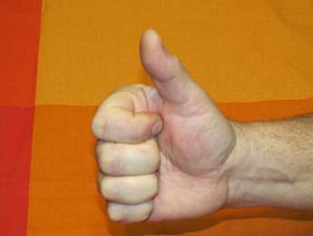 Разработать пальцы после. Кисть после инсульта. Пальцы руки после инсульта. Упражнения для восстановления подвижности пальцев рук инсульт.