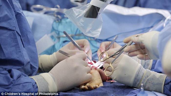 Медики впервые в истории пересадили ребенку кисти рук
